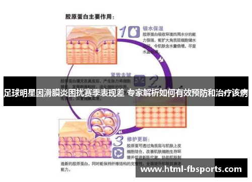 足球明星因滑膜炎困扰赛季表现差 专家解析如何有效预防和治疗该病